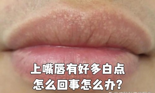 【含胆固醇高的食物排行榜】含胆固醇高的食物排行榜前十名 - 含胆固醇高食物有哪些食物网